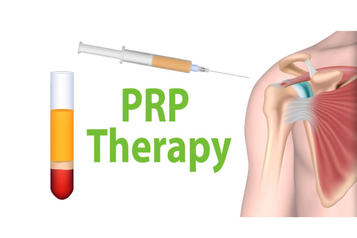 PRP Therapy Tritin Medical